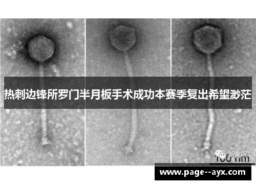 热刺边锋所罗门半月板手术成功本赛季复出希望渺茫